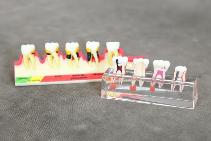 上尾歯周病治療専門