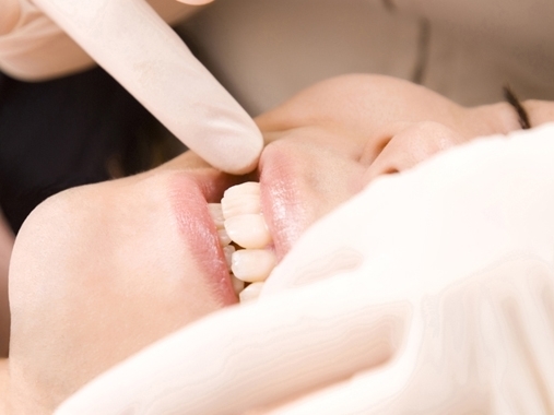 上尾の歯医者で痛くない歯周病の歯石除去