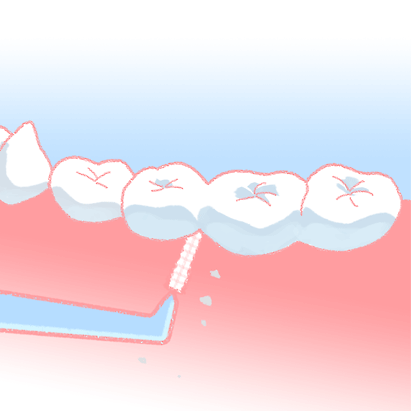 上尾市の歯医者の歯間ブラシ