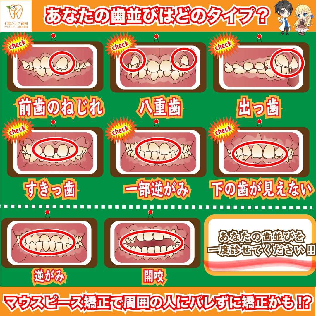 上尾の歯医者で歯並び改善