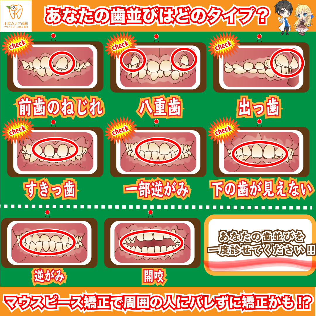 マウスピース矯正ならカナデ歯科