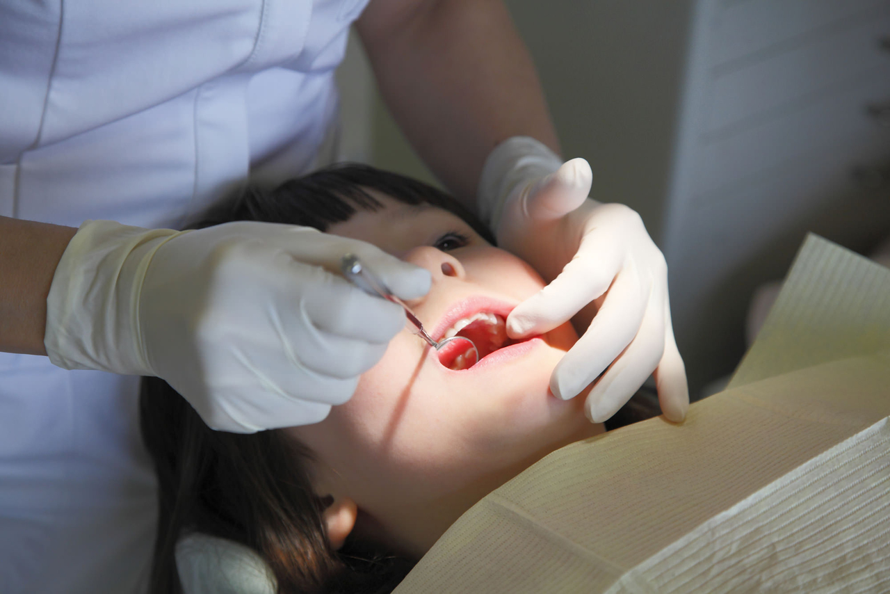 歯周病のための歯石除去