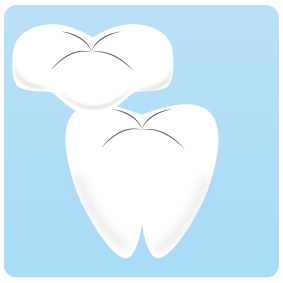 セラミックによりすきっ歯の改善