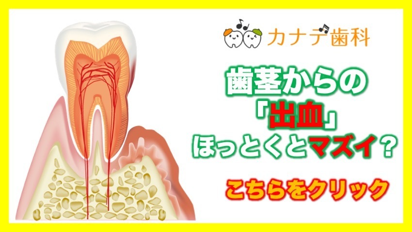 上尾の痛くない歯医者で歯茎の腫れ応急処置