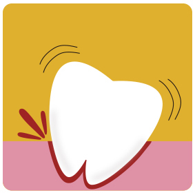 歯周病で歯がぐらぐら